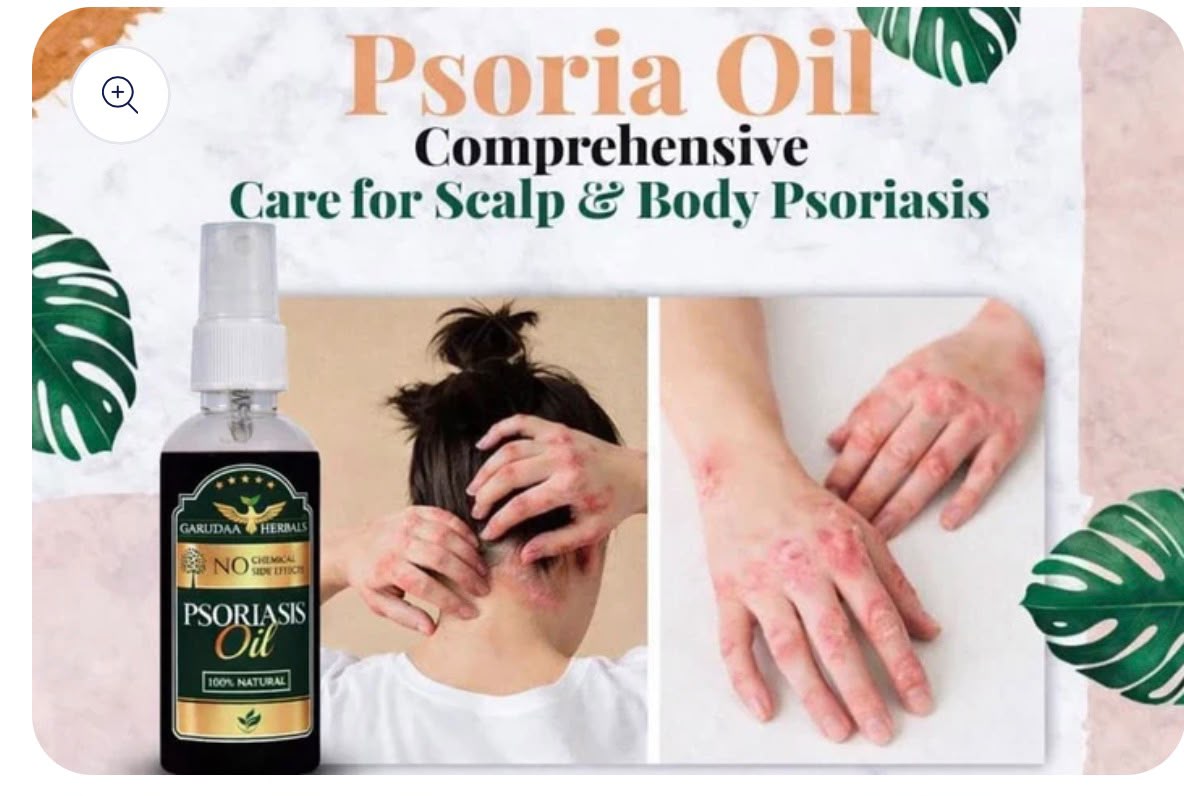 Psoriasis Herbal Relief Oil