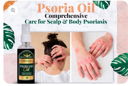 Psoriasis Herbal Relief Oil